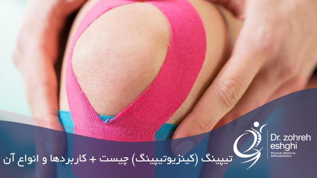 تیپینگ چیست