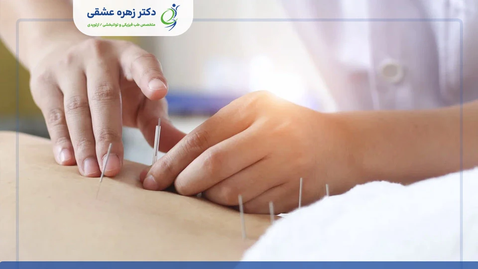 متخصص طب سوزنی در شیراز