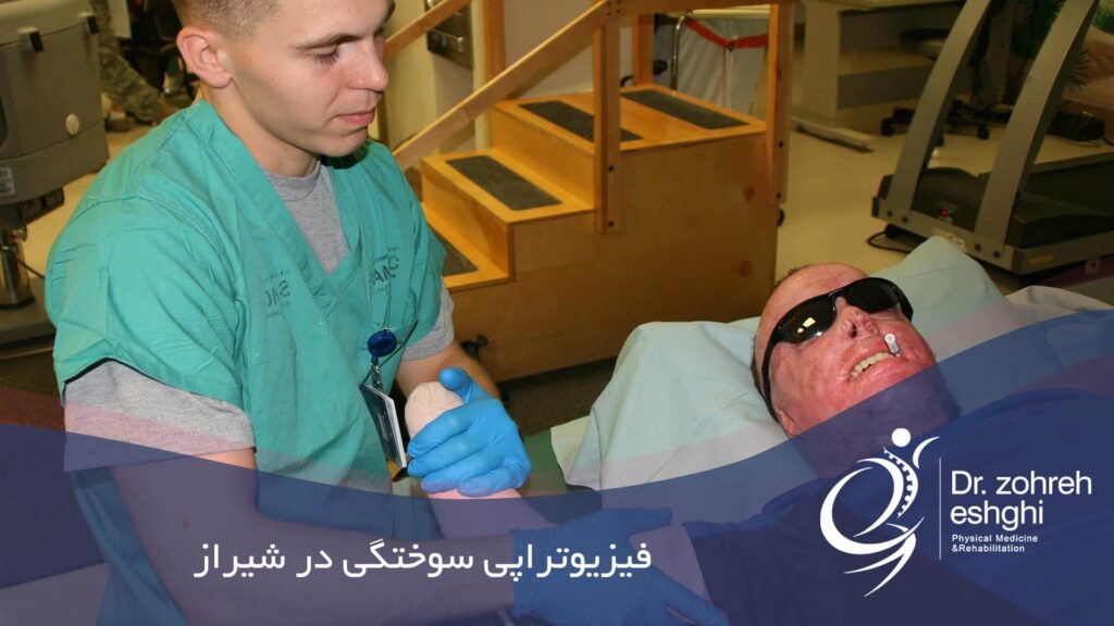فیزیوتراپی سوختگی در شیراز