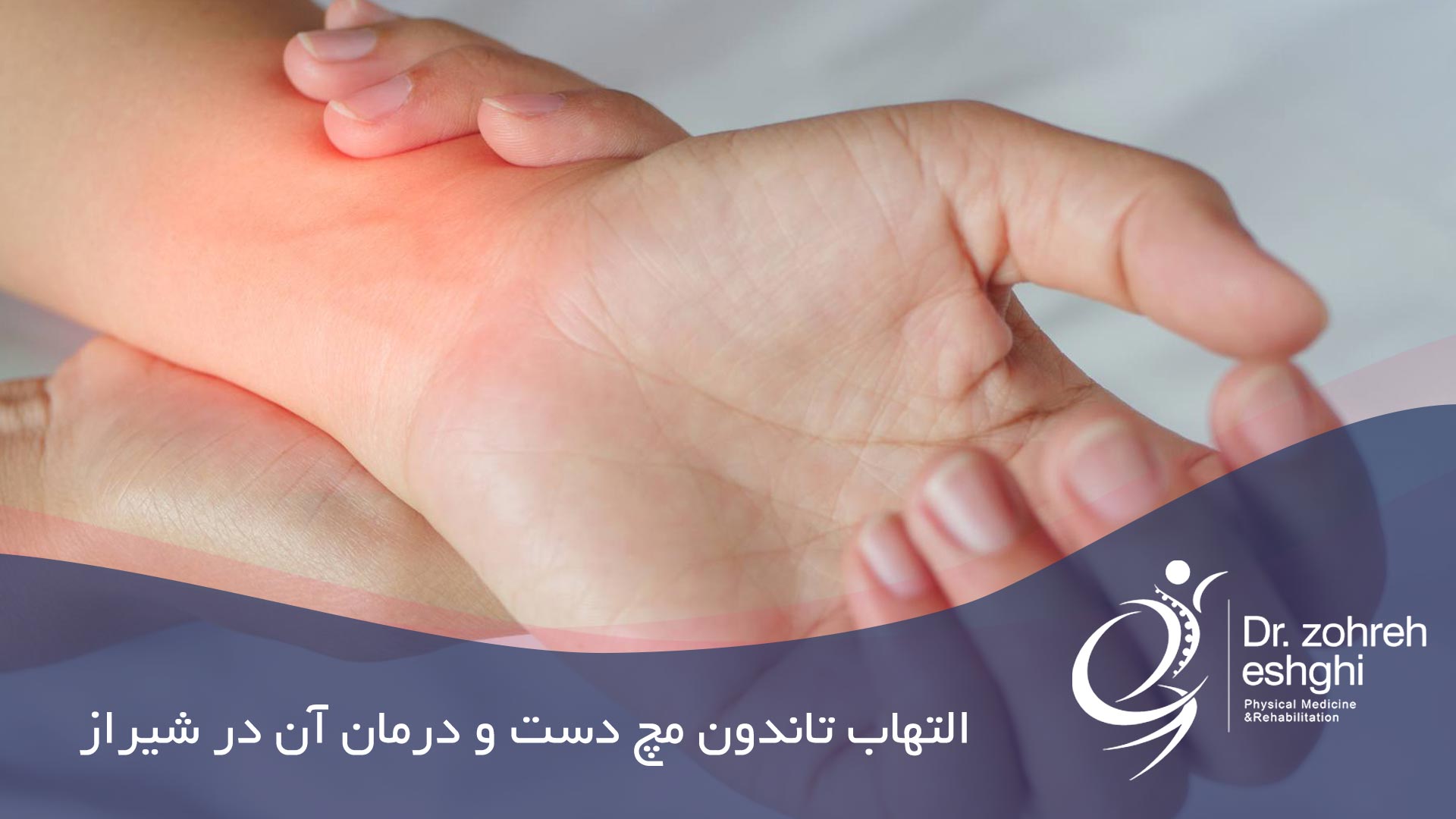 التهاب تاندون مچ دست و درمان آن در شیراز