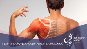 درمان التهاب تاندون شانه در شیراز