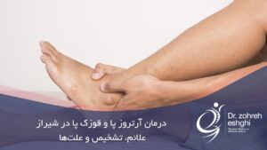 درمان آرتروز پا و قوزک پا