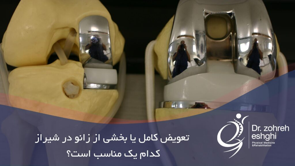 تعویض کامل یا بخشی از مفصل زانو