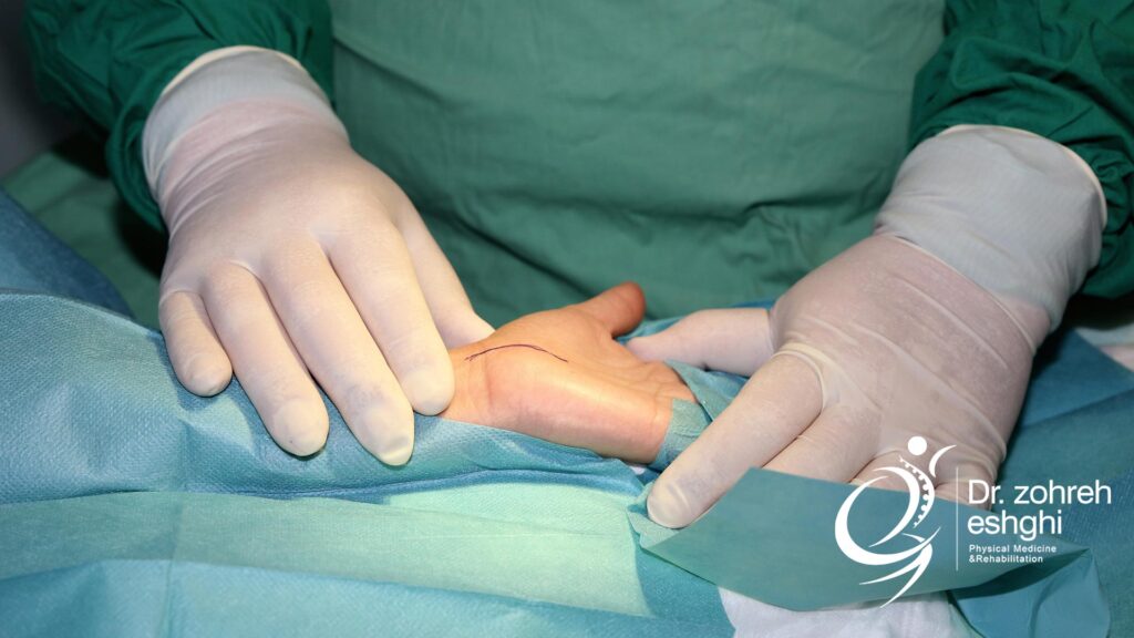 جراحی انقباض دوپویترن کف دست