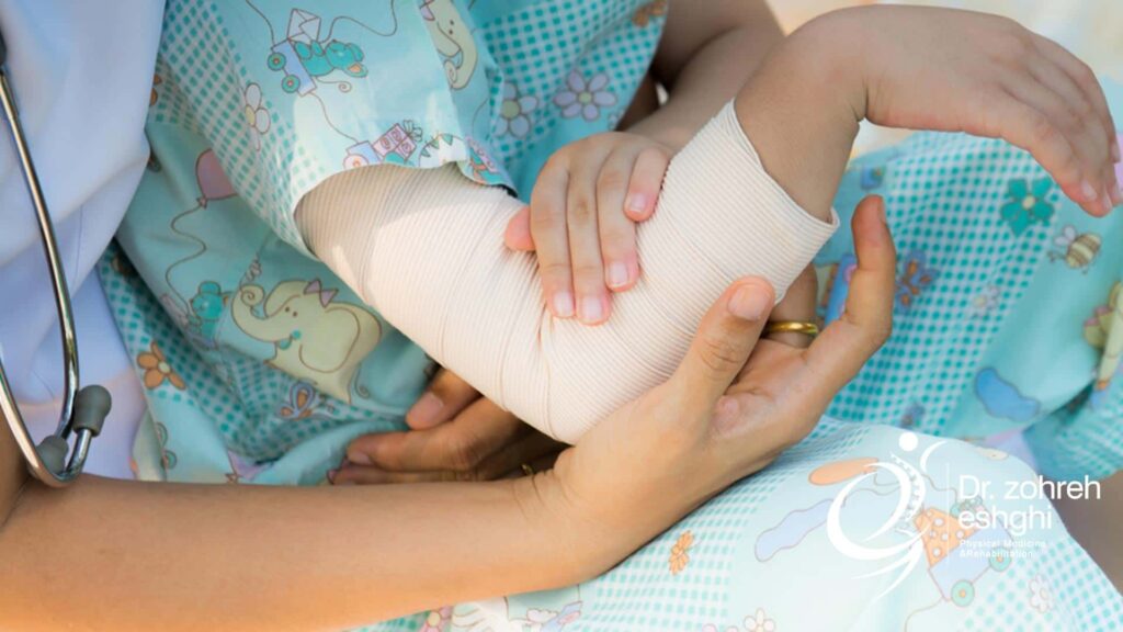 اقدامات لازم پس از شکستگی استخوان در کودکان