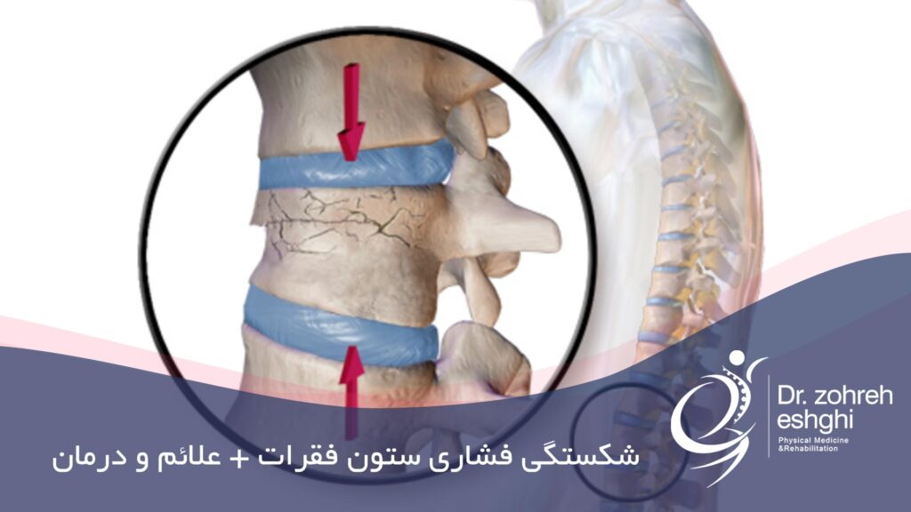 شکستگی ستون فقرات چیست