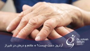 درمان آرتروز دست در شیراز