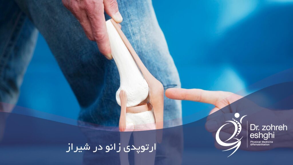 ارتوپدی زانو در شیراز