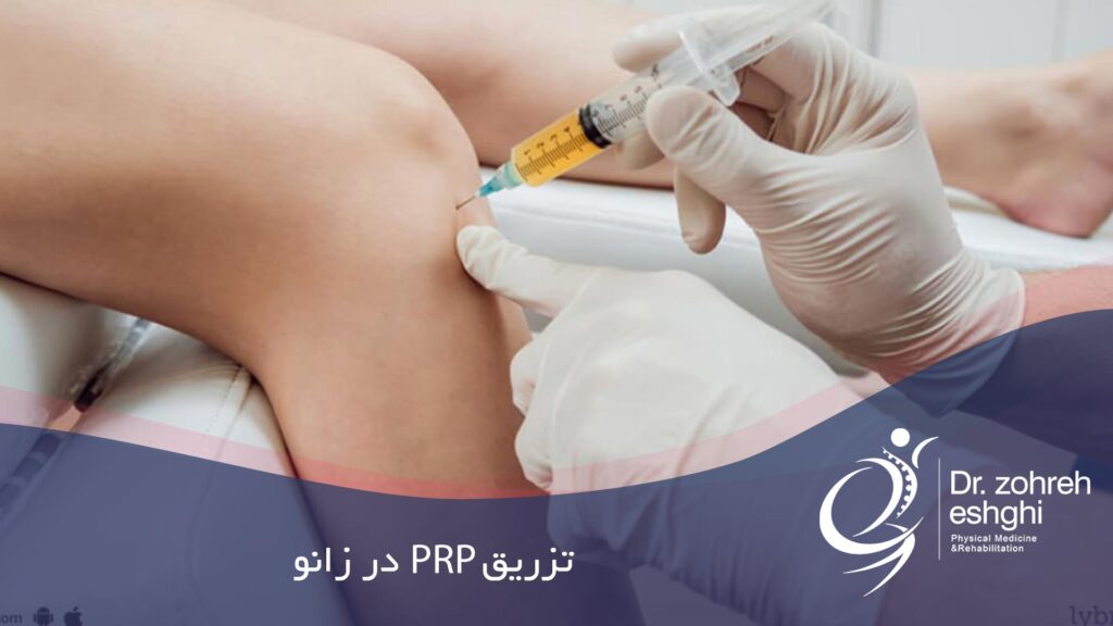 تزریق PRP پی آر پی در زانو