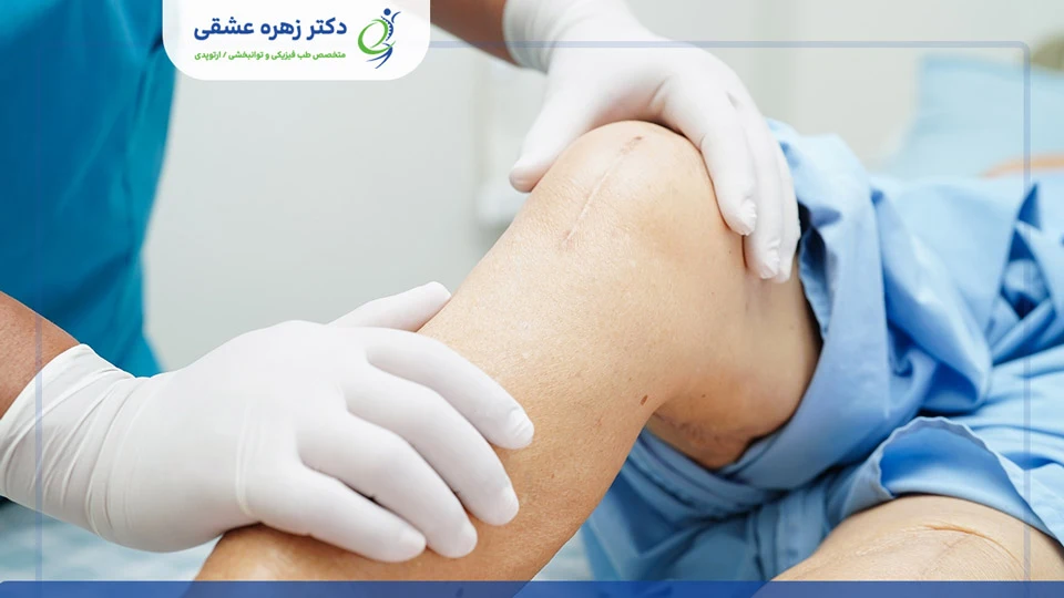 ریکاوری بعد از جراحی زانو