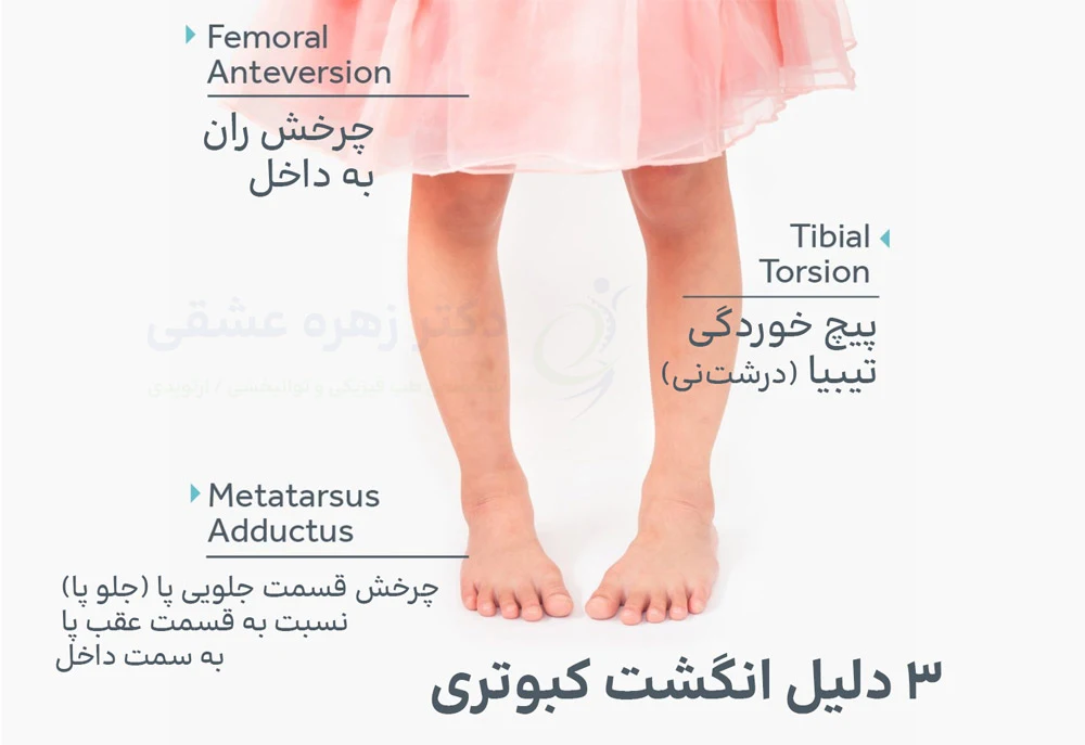 3 علت انگشت کبوتری