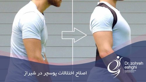 اصلاح اختلالات پوسچر بدن در شیراز
