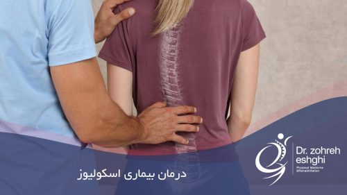 درمان بیماری اسکولیوز