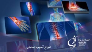 انواع آسیب های مفصلی
