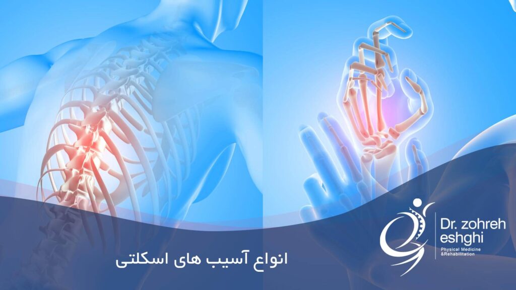 انواع آسیب های اسکلتی