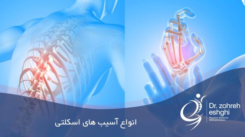 انواع آسیب های اسکلتی