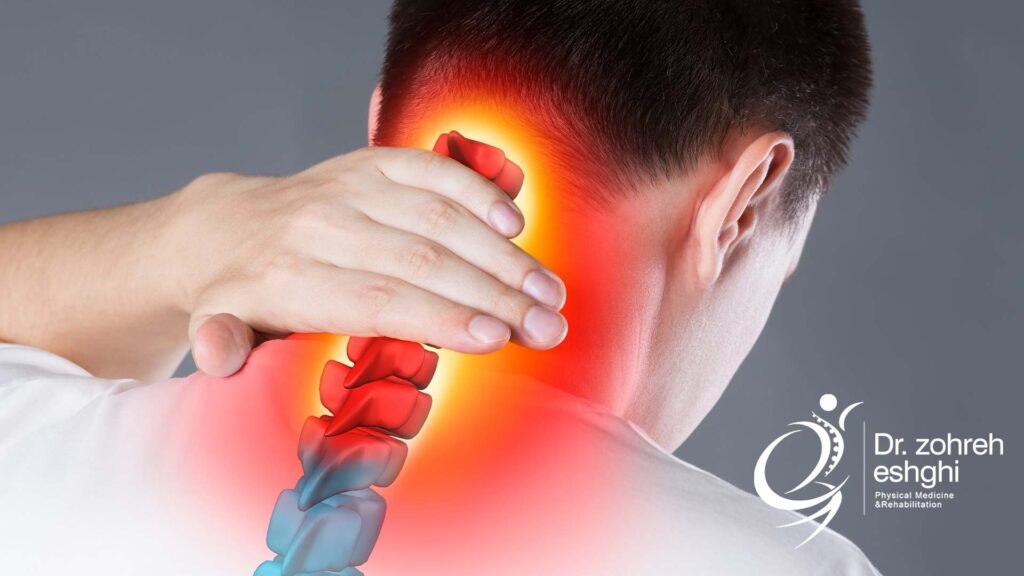 علائم گیر افتادگی عصب گردن چیست