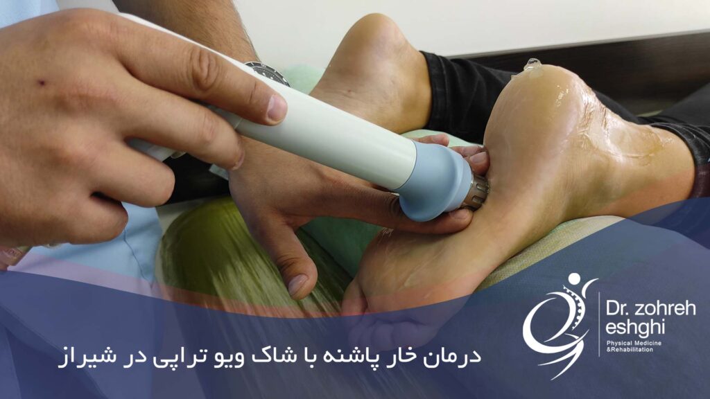 درمان خار پاشنه با شاک ویو تراپی در شیراز
