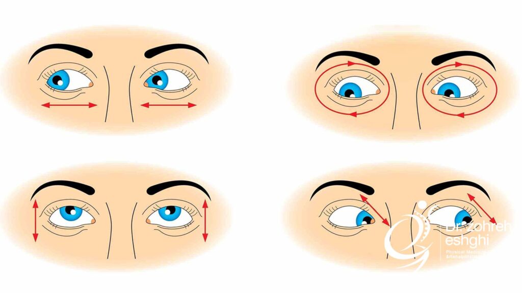 تمرینات فیزیوتراپی چشم تنبل