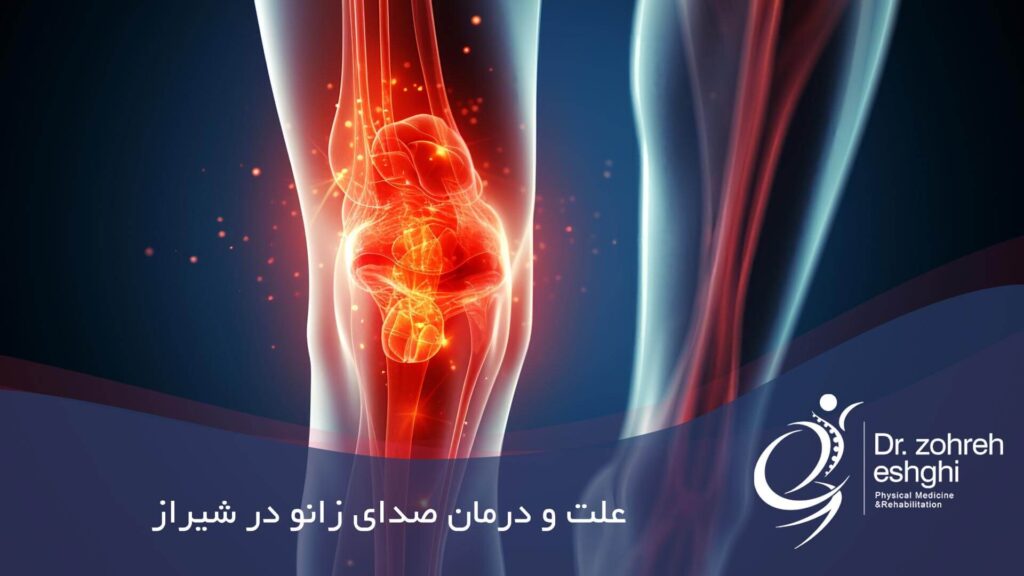 علت و درمان صدای زانو در شیراز
