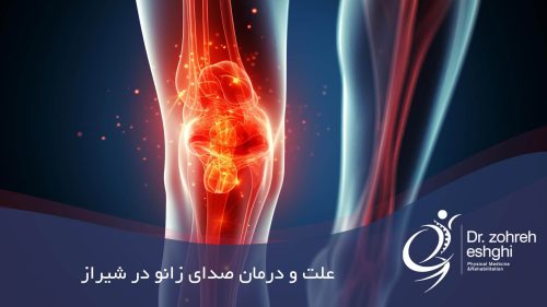 علت و درمان صدای زانو در شیراز