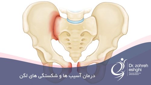 درمان آسیب ها و شکستگی های لگن