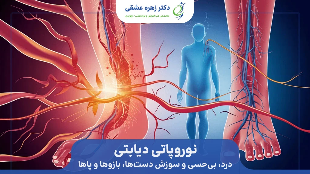 نوروپاتی دیابتی
