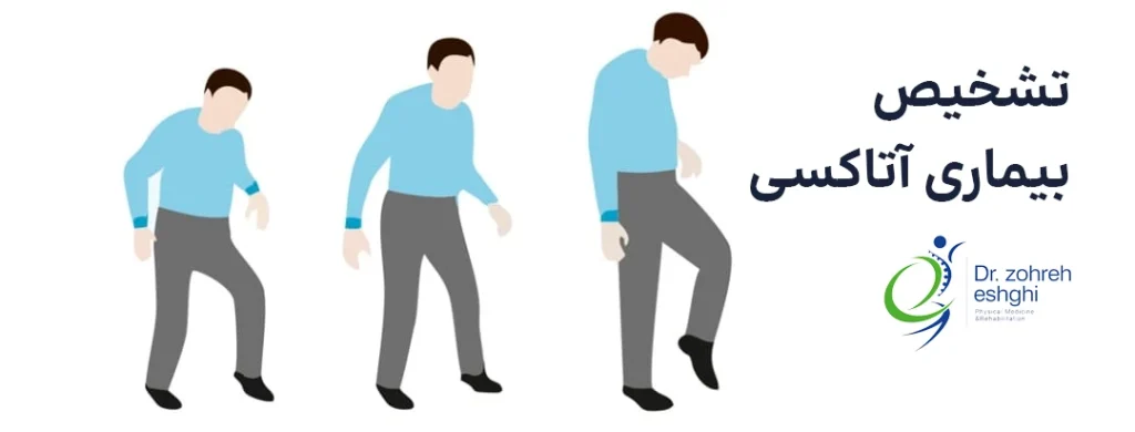 تشخیص بیماری آتاکسی