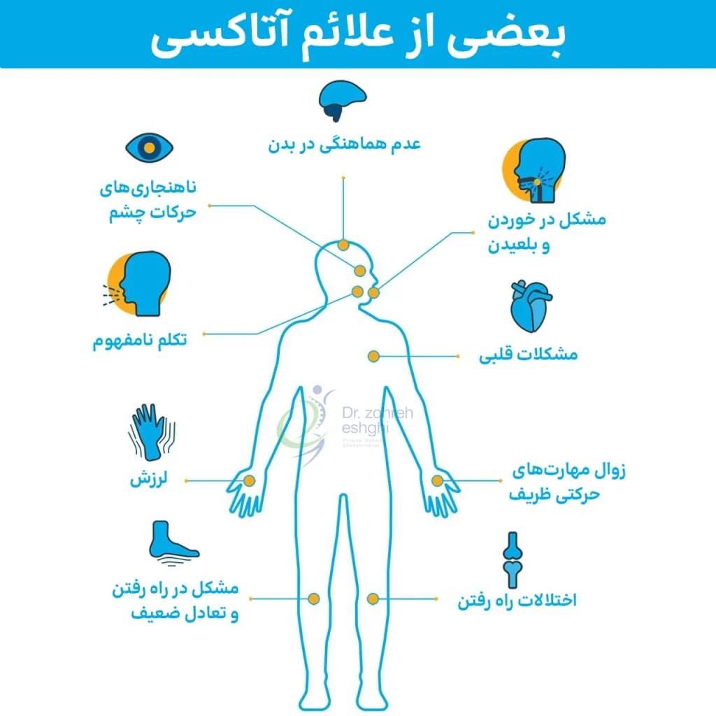 علائم آتاکسی مخچه‌ای-نخاعی (SCA)