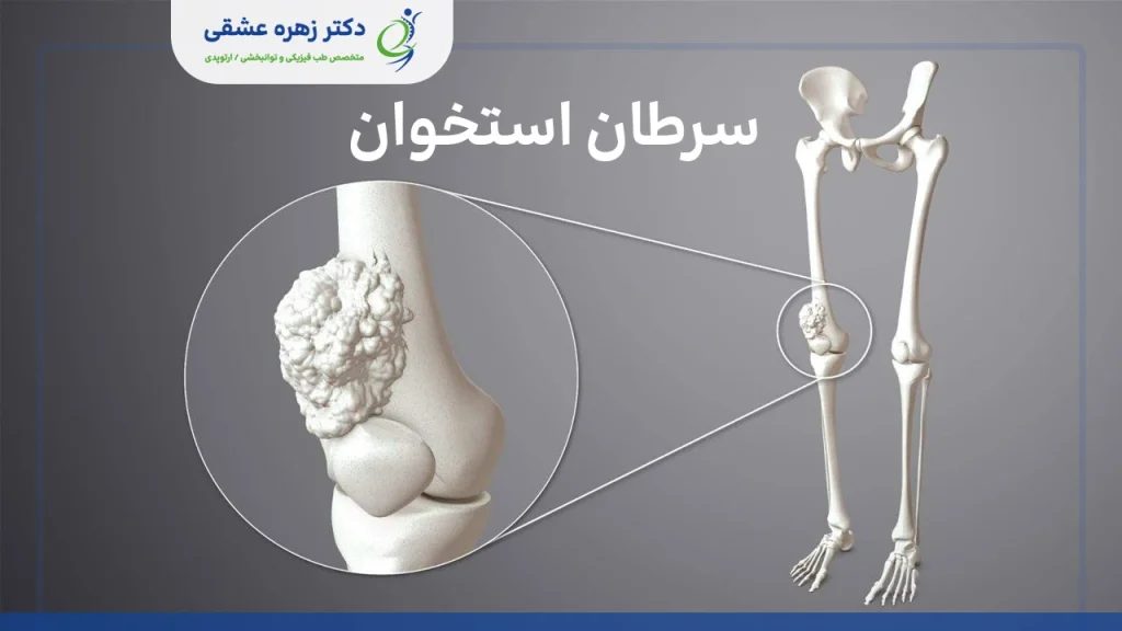 شکل سرطان استخوان