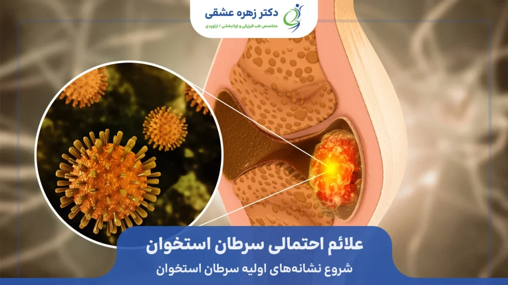 علائم اولیه سرطان استخوان
